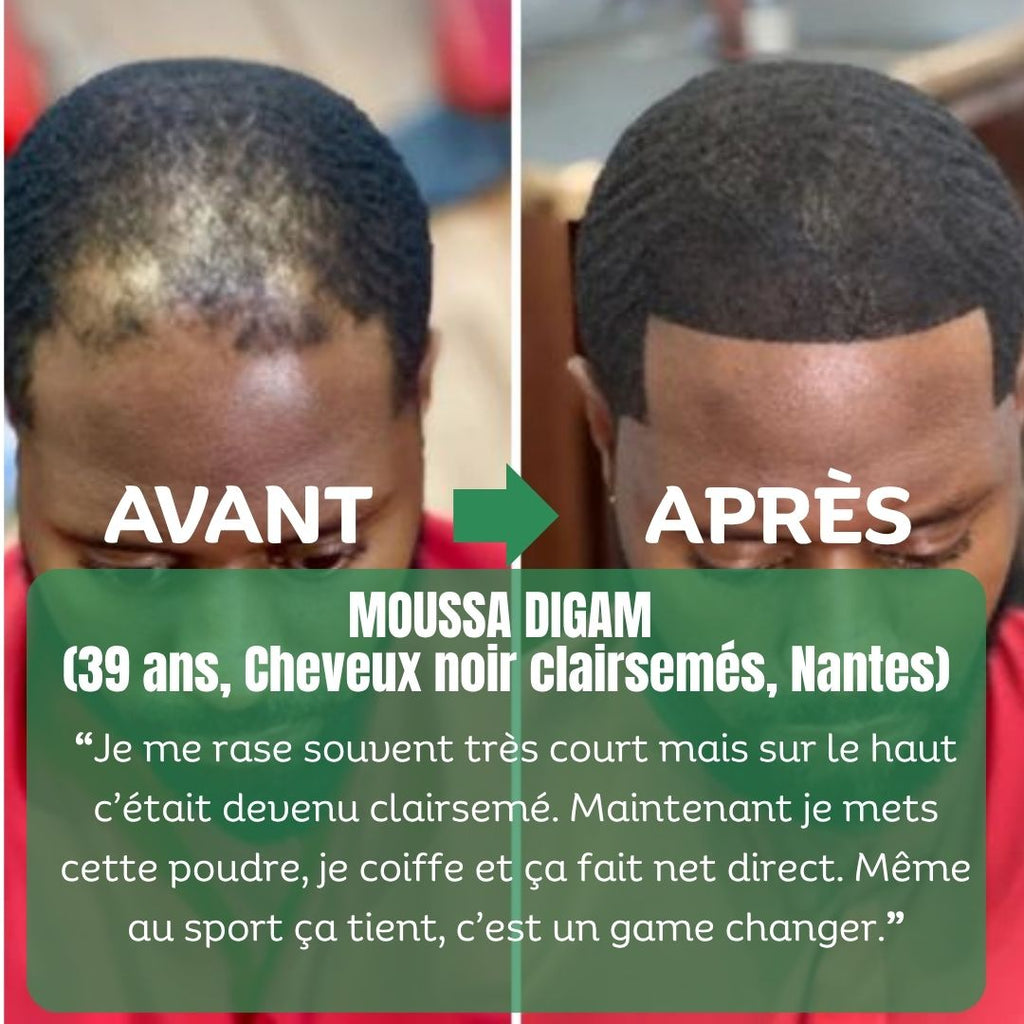 Pack Densité Ultime